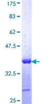 SDS-PAGE: Recombinant Human NDP52 GST (N-Term) Protein [H00010241-Q01]