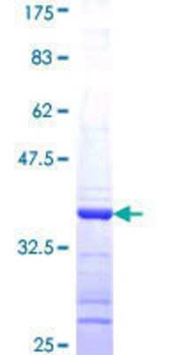 SDS-PAGE: Recombinant Human Gephyrin/GPHN GST (N-Term) Protein [H00010243-Q01]