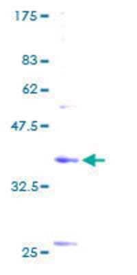 SDS-PAGE: Recombinant Human BET1 GST (N-Term) Protein [H00010282-P01]