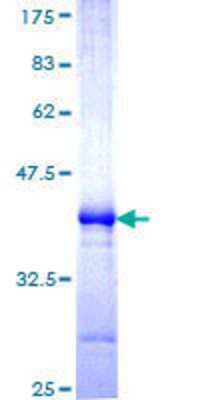 SDS-PAGE: Recombinant Human MARCH6 GST (N-Term) Protein [H00010299-Q01]