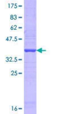 SDS-PAGE: Recombinant Human TCIRG1 GST (N-Term) Protein [H00010312-Q02]