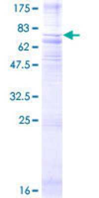 SDS-PAGE: Recombinant Human Neuromedin UR1/NMUR1 GST (N-Term) Protein [H00010316-P01]