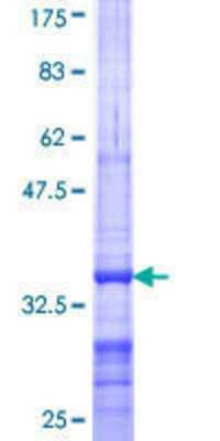 SDS-PAGE: Recombinant Human ABCA10 GST (N-Term) Protein [H00010349-Q01]