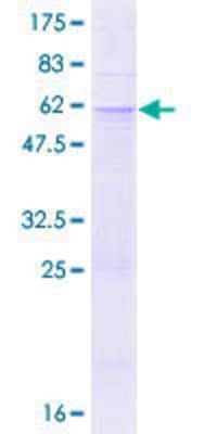 SDS-PAGE: Recombinant Human ABCA8 GST (N-Term) Protein [H00010351-P01]