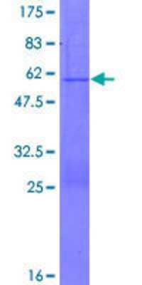 SDS-PAGE: Recombinant Human PGRMC2 GST (N-Term) Protein [H00010424-P01]