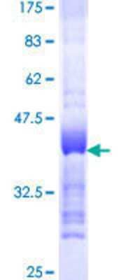 SDS-PAGE: Recombinant Human TACC3 GST (N-Term) Protein [H00010460-Q01]