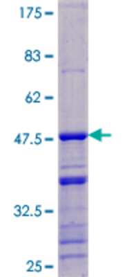 SDS-PAGE: Recombinant Human DDX17 GST (N-Term) Protein [H00010521-P01]