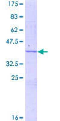 SDS-PAGE: Recombinant Human ORP150/HSP12A GST (N-Term) Protein [H00010525-P01]