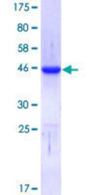 SDS-PAGE: Recombinant Human CTCF GST (N-Term) Protein [H00010664-Q01]