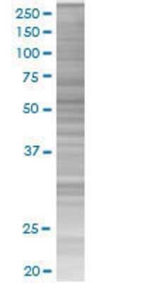 Other: ZBTB6 293T Cell Transient Overexpression Lysate [H00010773-T01]