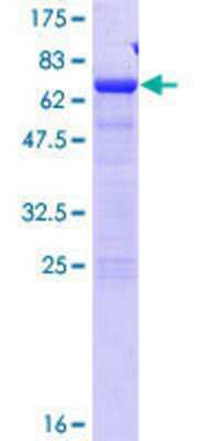 SDS-PAGE: Recombinant Human SDCCAG8 GST (N-Term) Protein [H00010806-P01]