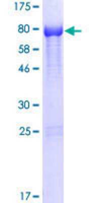 SDS-PAGE: Recombinant Human NOXA1 GST (N-Term) Protein [H00010811-P01]