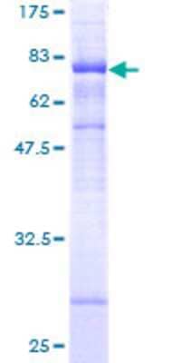 SDS-PAGE: Recombinant Human STARD3 GST (N-Term) Protein [H00010948-P01]