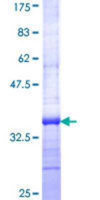 SDS-PAGE: Recombinant Human FATP5/SLC27A5 GST (N-Term) Protein [H00010998-Q01]