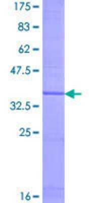 SDS-PAGE: Recombinant Human ERG28 GST (N-Term) Protein [H00011161-P01]