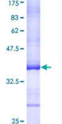 SDS-PAGE: Recombinant Human CEP250 GST (N-Term) Protein [H00011190-Q01]