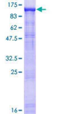 SDS-PAGE: Recombinant Human Gemin 3 GST (N-Term) Protein [H00011218-P02]