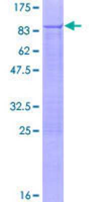 SDS-PAGE: Recombinant Human PNK GST (N-Term) Protein [H00011284-P01]