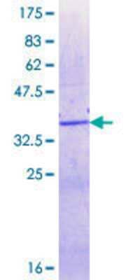 SDS-PAGE: Recombinant Human XRN2 GST (N-Term) Protein [H00022803-Q01]