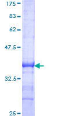 SDS-PAGE: Recombinant Human SCMH1 GST (N-Term) Protein [H00022955-Q01]