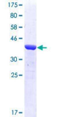 SDS-PAGE: Recombinant Human TPX2 GST (N-Term) Protein [H00022974-Q01]