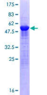 SDS-PAGE: Recombinant Human SAMD4A GST (N-Term) Protein [H00023034-P01]