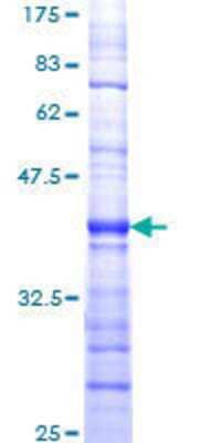 SDS-PAGE: Recombinant Human SMG1 GST (N-Term) Protein [H00023049-Q01]