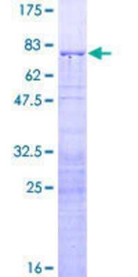 SDS-PAGE: Recombinant Human RRS1 GST (N-Term) Protein [H00023212-P01]