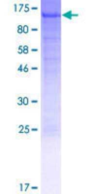 SDS-PAGE: Recombinant Human NUP210 GST (N-Term) Protein [H00023225-P01]