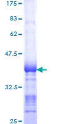 SDS-PAGE: Recombinant Human SNF1LK2/SIK2 GST (N-Term) Protein [H00023235-Q01]