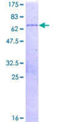 SDS-PAGE: Recombinant Human SMCHD1 GST (N-Term) Protein [H00023347-P01]