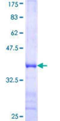 SDS-PAGE: Recombinant Human LARG GST (N-Term) Protein [H00023365-Q01]