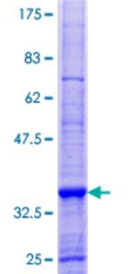 SDS-PAGE: Recombinant Human p114RhoGEF GST (N-Term) Protein [H00023370-P01]