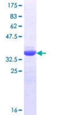 SDS-PAGE: Recombinant Human TORC1 GST (N-Term) Protein [H00023373-Q01]