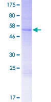 SDS-PAGE: Recombinant Human FRAT2 GST (N-Term) Protein [H00023401-P01]