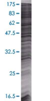 Other: Sirtuin 5/SIRT5 293T Cell Transient Overexpression Lysate [H00023408-T01]