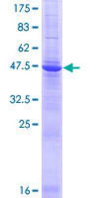 SDS-PAGE: Recombinant Human TMED3 GST (N-Term) Protein [H00023423-P01]