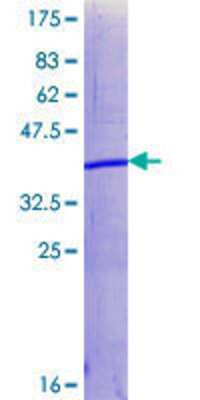 SDS-PAGE: Recombinant Human SUZ12 GST (N-Term) Protein [H00023512-Q01]