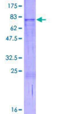 SDS-PAGE: Recombinant Human RUSC1 GST (N-Term) Protein [H00023623-P01]