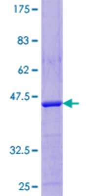 SDS-PAGE: Recombinant Human LDOC1 GST (N-Term) Protein [H00023641-P01]