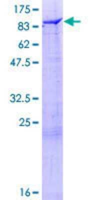 SDS-PAGE: Recombinant Human RIPK5 GST (N-Term) Protein [H00025778-P01]