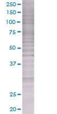 Other: RAD54B 293T Cell Transient Overexpression Lysate [H00025788-T01]