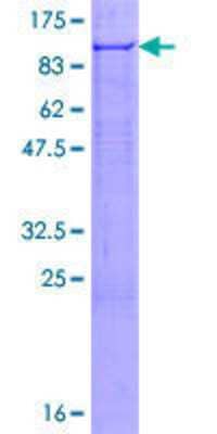 SDS-PAGE: Recombinant Human FBXO7 GST (N-Term) Protein [H00025793-P01]