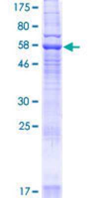 SDS-PAGE: Recombinant Human YIPF3 GST (N-Term) Protein [H00025844-P01]