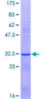 SDS-PAGE: Recombinant Human PART1 GST (N-Term) Protein [H00025859-P01]