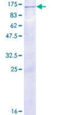 SDS-PAGE: Recombinant Human Protein Kinase D2 GST (N-Term) Protein [H00025865-P01]