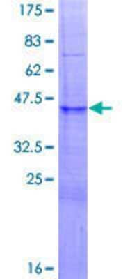 SDS-PAGE: Recombinant Human SIN3A GST (N-Term) Protein [H00025942-P01]