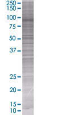 Other: TIAM2 293T Cell Transient Overexpression Lysate [H00026230-T01]