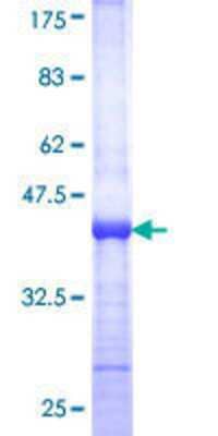 SDS-PAGE: Recombinant Human TIN2 GST (N-Term) Protein [H00026277-Q01]