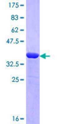 SDS-PAGE: Recombinant Human Neurobeachin GST (N-Term) Protein [H00026960-Q01]